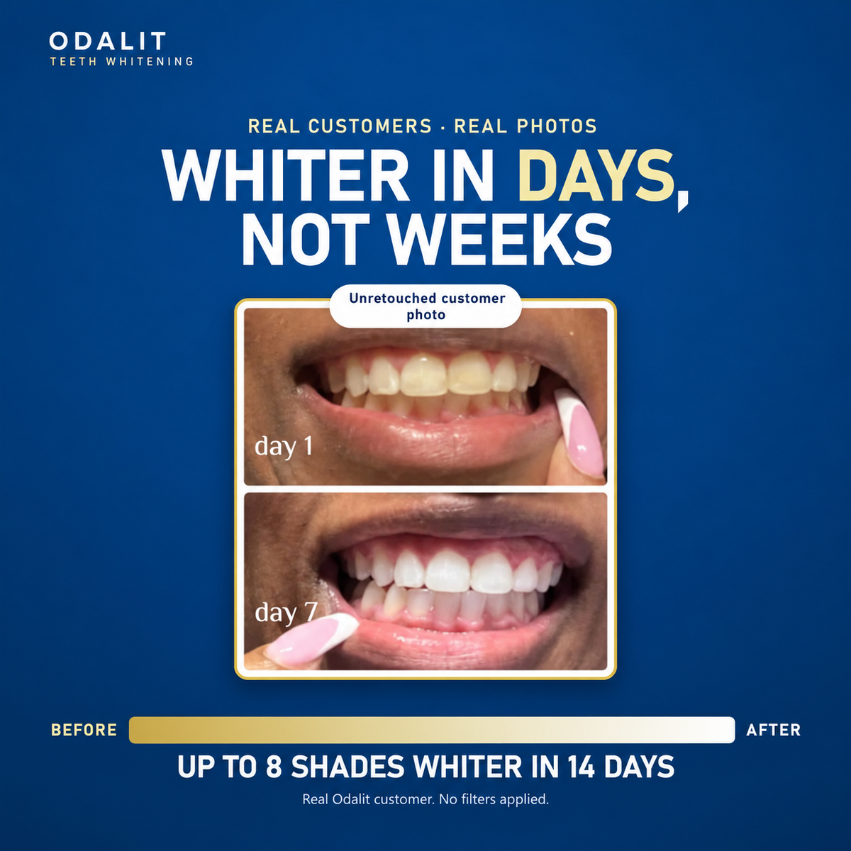 Whiter Teeth in Minutes · ODALIT™ Gold Whitening Pen