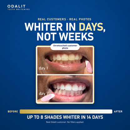 Whiter Teeth in Minutes · ODALIT™ Gold Whitening Pen
